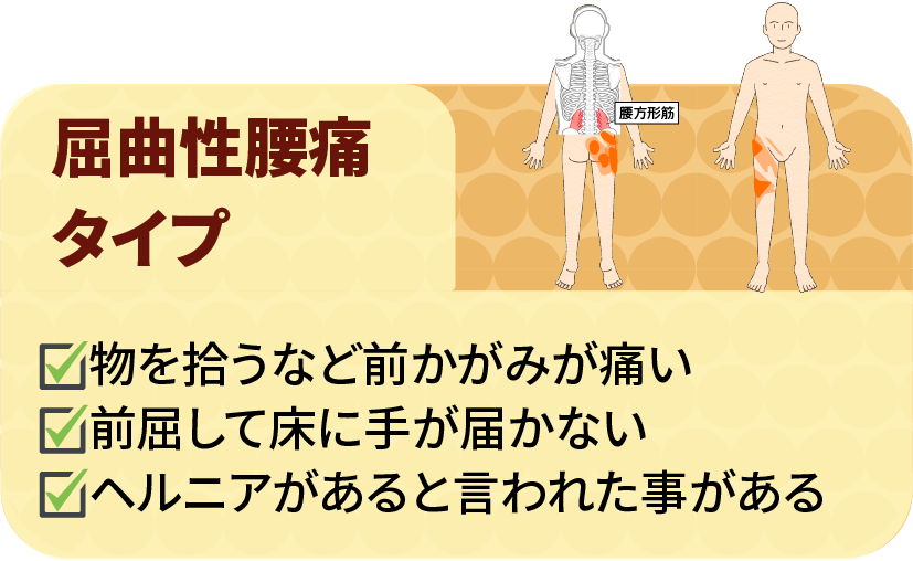 腰痛タイプ1:歪曲性腰痛タイプ