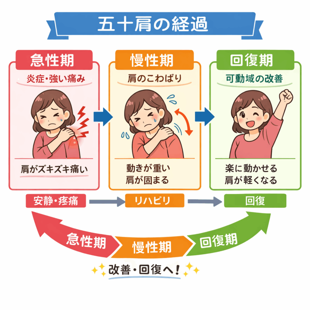 50肩回復期など五十肩の経過説明図